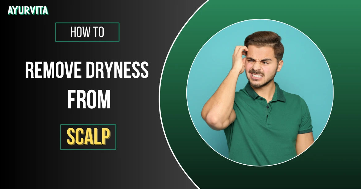 How to Remove Dryness from Scalp